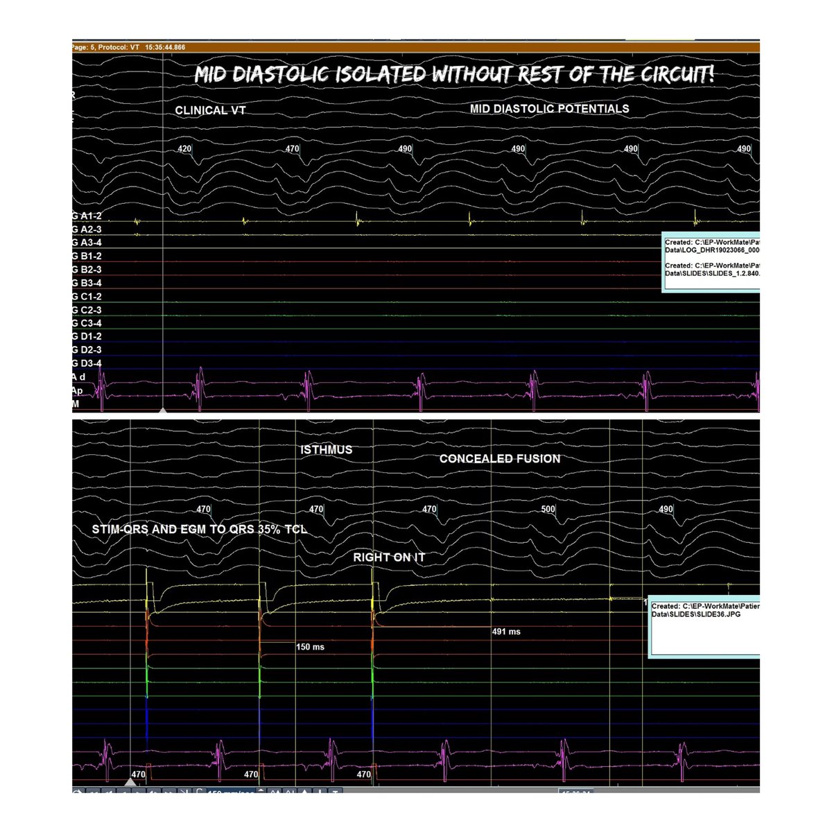 @NiteshSoodMD tweet media