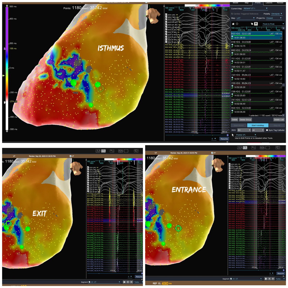 @NiteshSoodMD tweet media