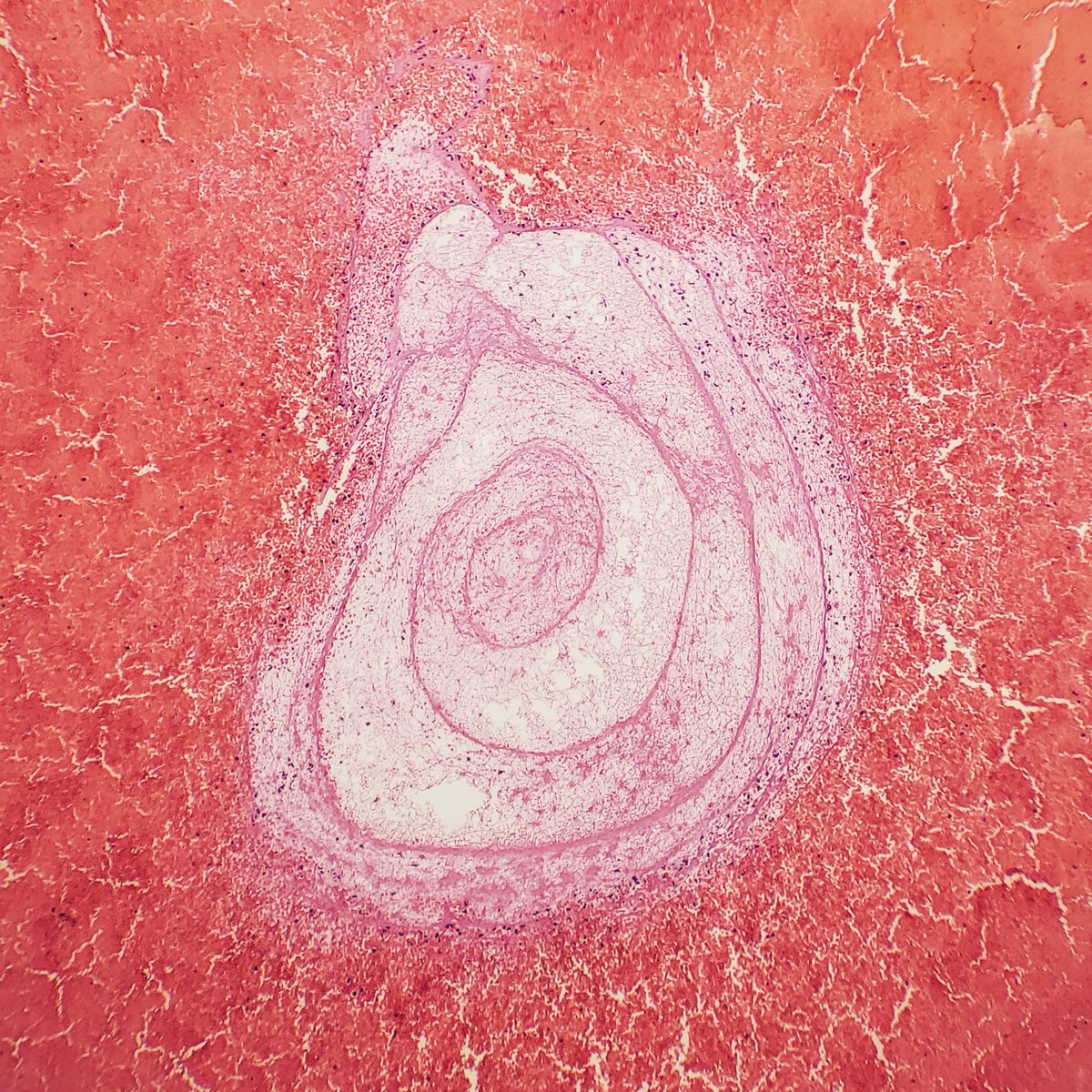 The way this fibrin created this spiral... 🐚🍥 #PathArt