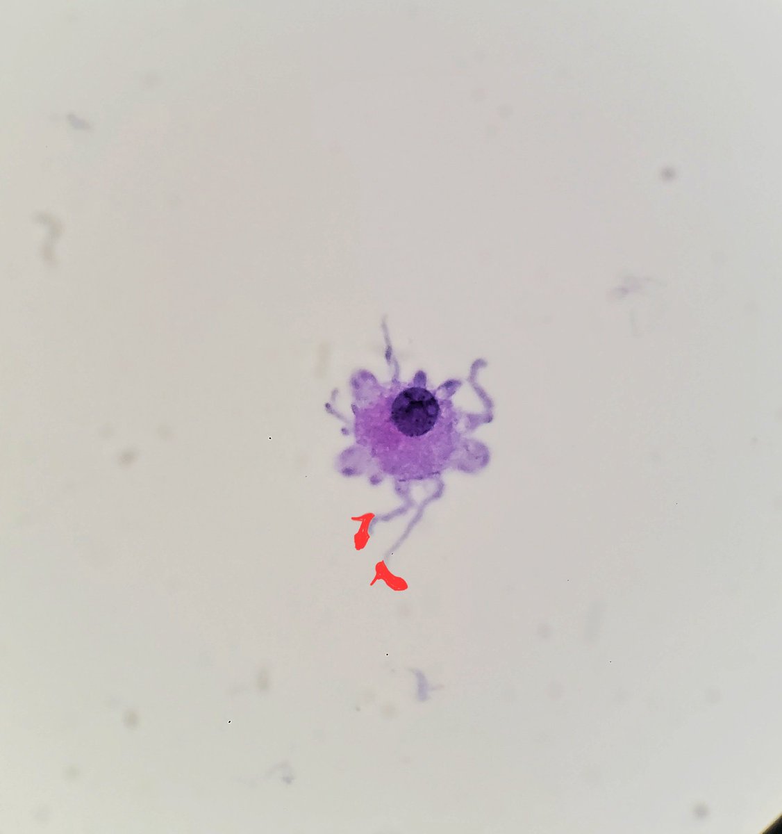 This little cell is so happy, and ready to paint the town red! ☺️💃 #PathArt