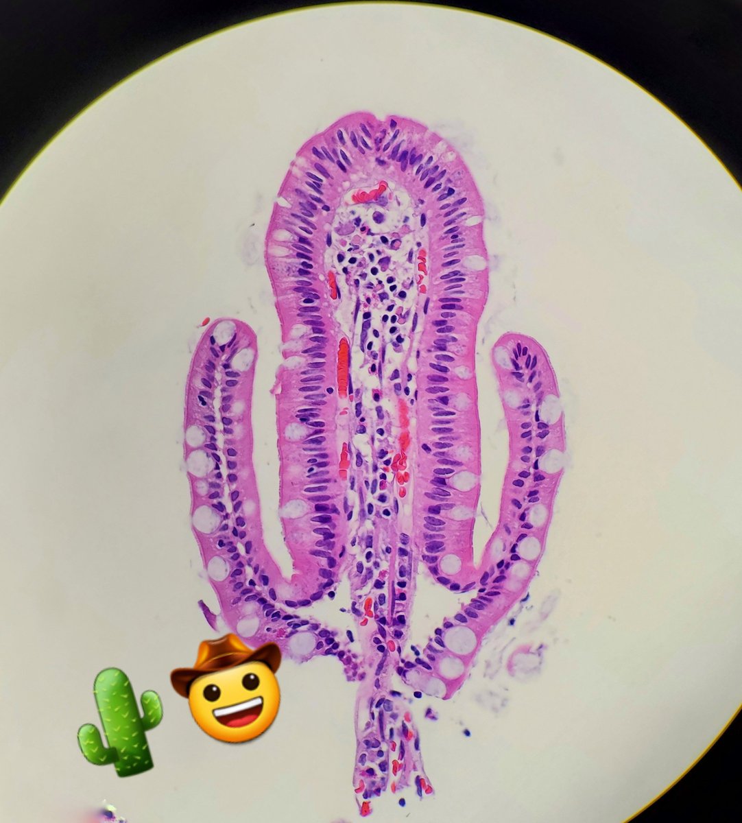 Y'all be mindful of those prickly intestinal villi out there! #PathArt