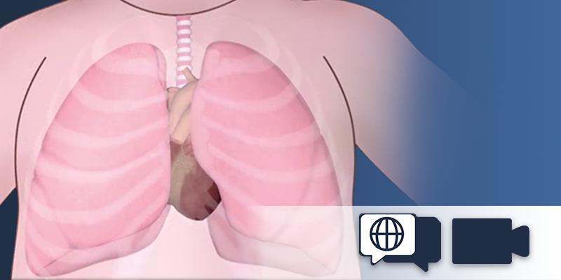 OPENPediatrics's tweet photo. Watch as Dr. Jordan Rettig discusses cardiopulmonary interactions pertaining to positive pressure ventilation. https://t.co/yYmHHy39N7 #CardioTwitter #PedsCard #PedsICU https://t.co/HprOorbmhp