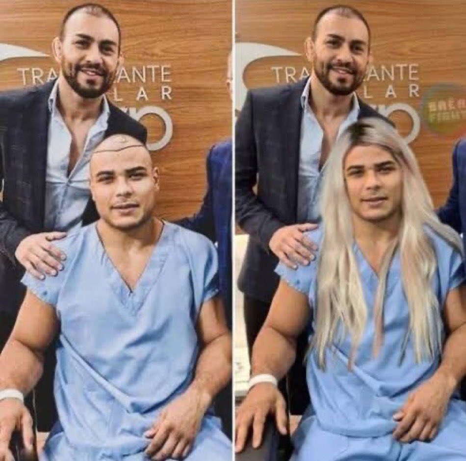 One more surgery 🤣