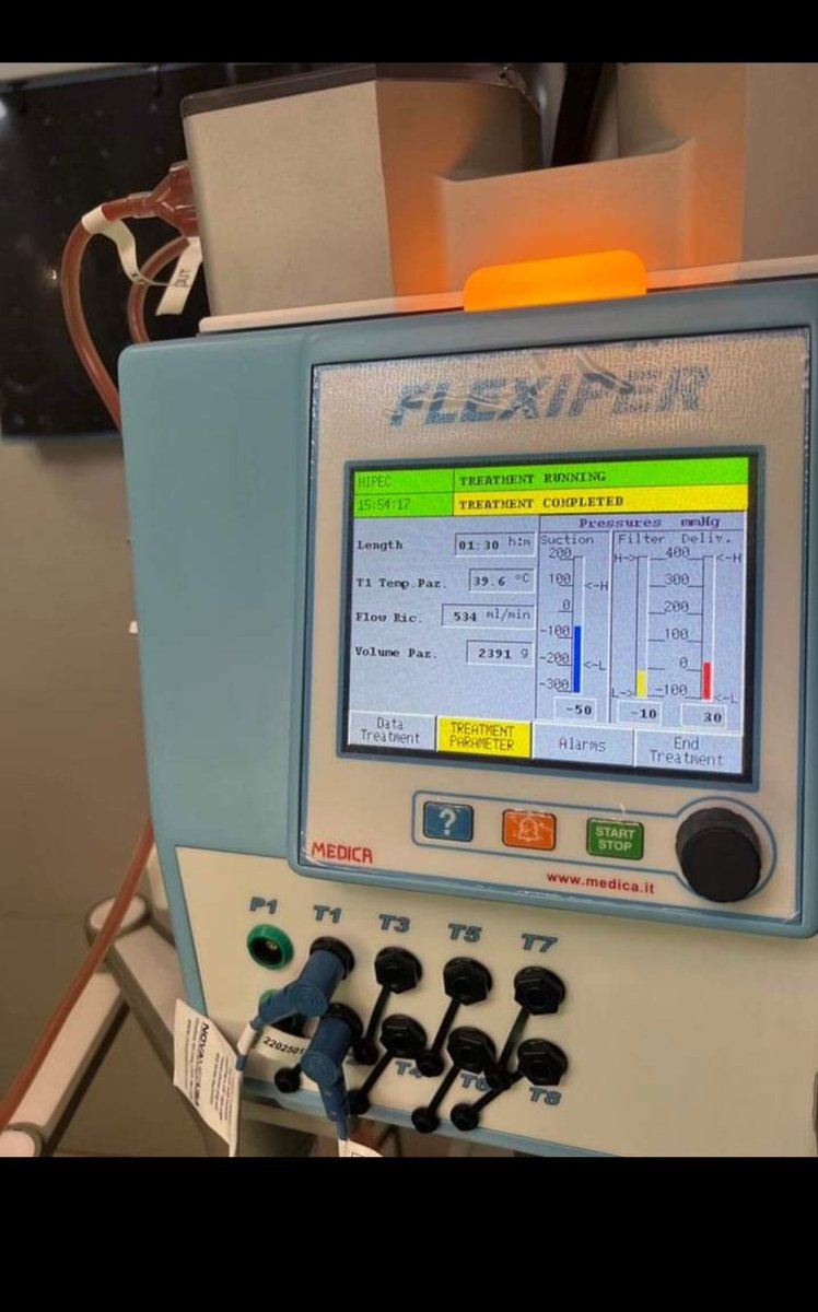 Deeplamichhane3's tweet photo. Happy to share that we are able to start HIPEC services in Nepal at Bhaktapur Cancer Hospital, Kathmandu.
First case recovering well and second posted today. 
Learning over the years and finally execution gives motivation. https://t.co/VdzEYeQQm1