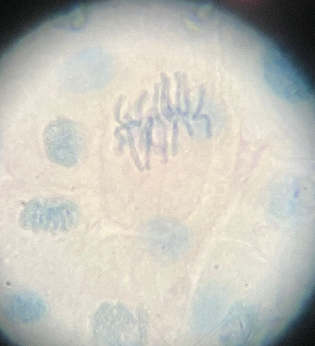 stw_science's tweet image. Dr Larrington's @SWSixthForm class prepared stained squashes of cells from garlic root tips to observe the stages of mitosis 🔬 #Metaphase #Anaphase #Biology