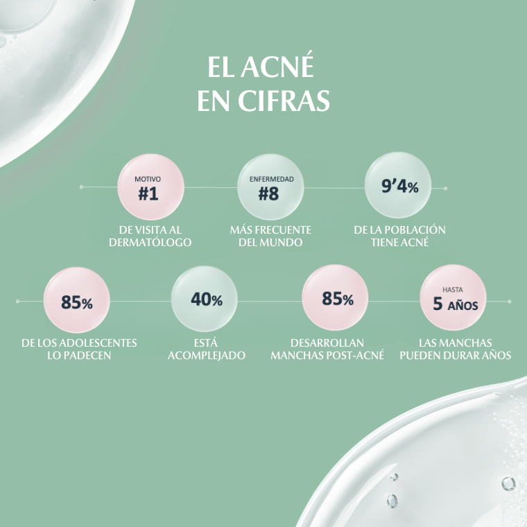 EucerinES's tweet photo. ¿Sabías que el 9,4% de la población tiene #acné? ¿o que un 85% de los adolescentes lo padecen?👇
Revelamos algunas cifras porque haciéndolo visible, concienciando y enseñando cómo tratarlo, podremos combatir el acné y su estigma. #StopStigma
#Eucerin #DermoPure https://t.co/9idalk8PDP