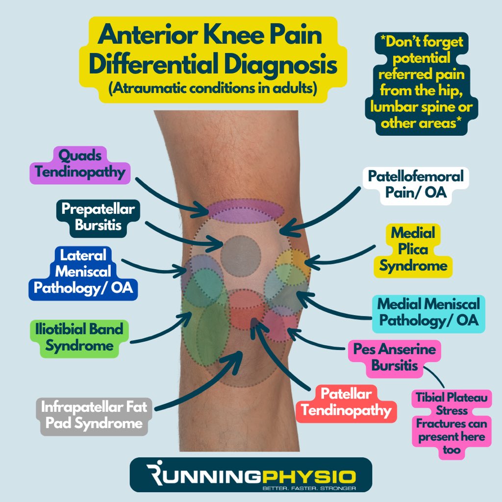There are lots of potential causes of anterior knee pain! The common ones you’ll encounter in clinic are included in this graphic but there are a couple of important points to add…

Pain location alone is not sufficient to reach a diagnosis. Symptoms can vary significantly in