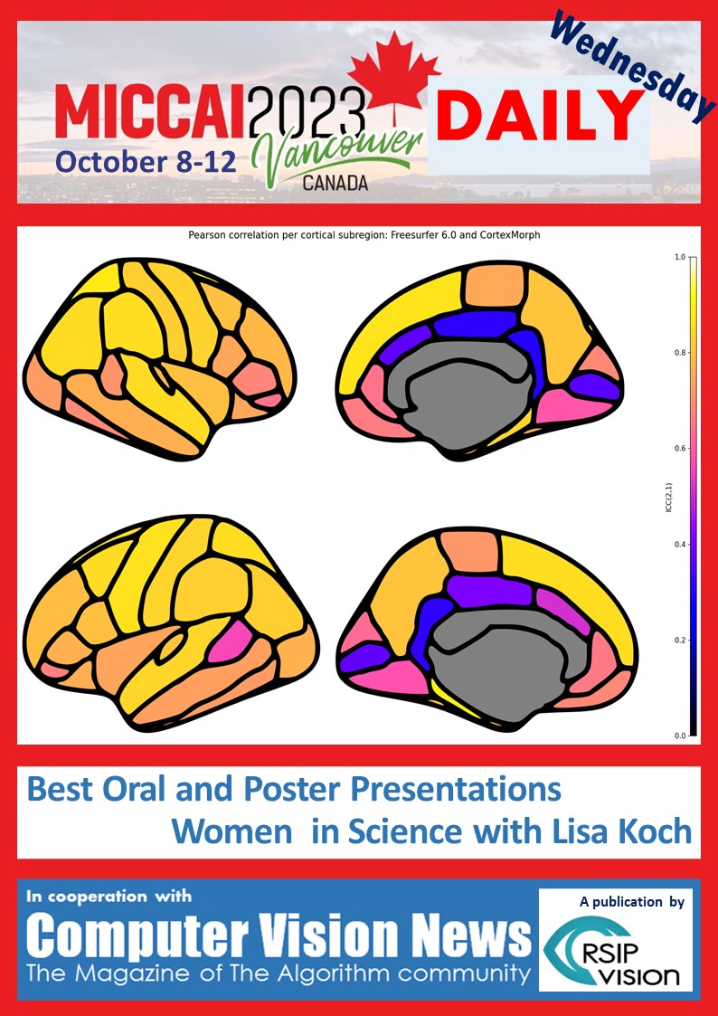 RSIP Vision (@rsipvision) on Twitter photo Good morning MICCAI!
MICCAI Daily of today (Wednesday)
Important community information at page 23!
Great poster reviews, great interviews and 5 mind-blowing slides of keynote Yann LeCun.
==> rsipvision.com/MICCAI2023-Wed…
Happy reading and have a great day at MICCAI 2023!
<a href="/RSIPvision/">RSIP Vision</a> Good morning MICCAI!
MICCAI Daily of today (Wednesday)
Important community information at page 23!
Great poster reviews, great interviews and 5 mind-blowing slides of keynote Yann LeCun.
==> rsipvision.com/MICCAI2023-Wed…
Happy reading and have a great day at MICCAI 2023!
<a href="/RSIPvision/">RSIP Vision</a>