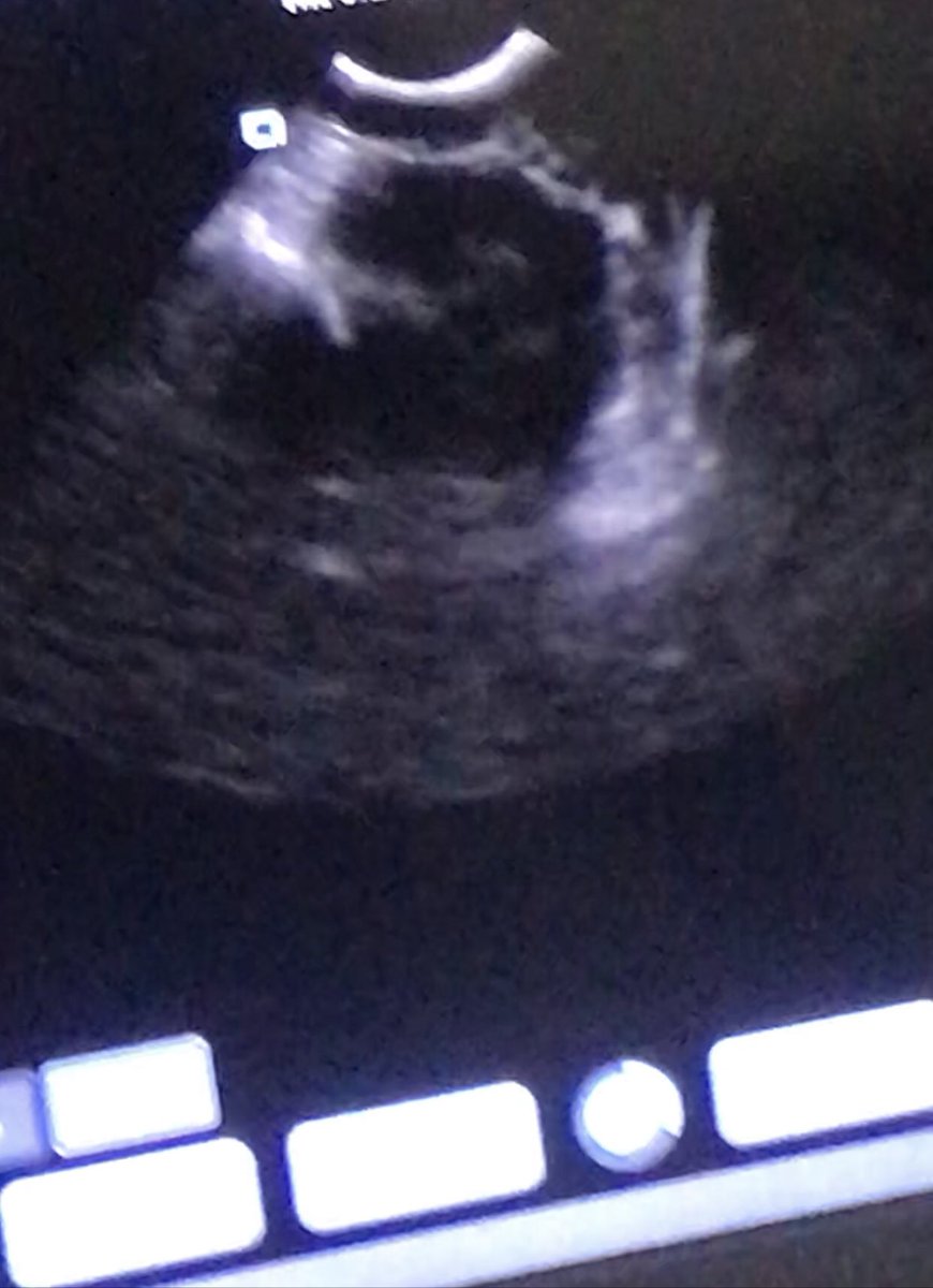 johnrack's tweet image. Just had the best news ever after a few months of heartache finally something good my lil beautiful baby girl is in pup exciting times ahead so happy gorn my lil girl 💥💥💥#butdarewasfour I can’t wait