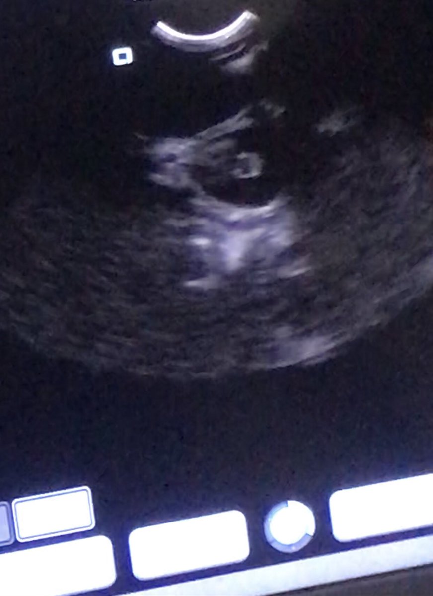 johnrack's tweet image. Just had the best news ever after a few months of heartache finally something good my lil beautiful baby girl is in pup exciting times ahead so happy gorn my lil girl 💥💥💥#butdarewasfour I can’t wait