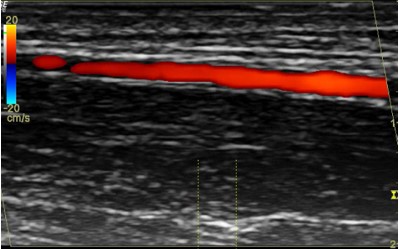 leonard_shapiro's tweet photo. CHAPTER 9💥Ultrasound Imaging for Musculoskeletal Research by @NkhensaniMogale In Biomedical Visualization Vol 2. @UPTuks  🇿🇦 Series Editor @medicalvis Editor @leonard_shapiro Published by @SpringerNature @TheNeuroNetwork  https://t.co/1yxioK1ZiG https://t.co/N1p7ytFC4J