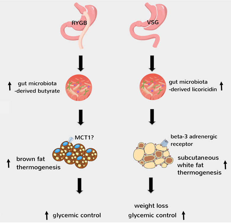 cell_stress's tweet photo. Fresh 'news and thoughts' article by @HankirMohammed: "Gut microbiota turn up the heat after bariatric surgery"

Read it for free: https://t.co/W7zP48orQa

And find it on PubMed:  https://t.co/NN1VOYdY5x https://t.co/HFN991juaX