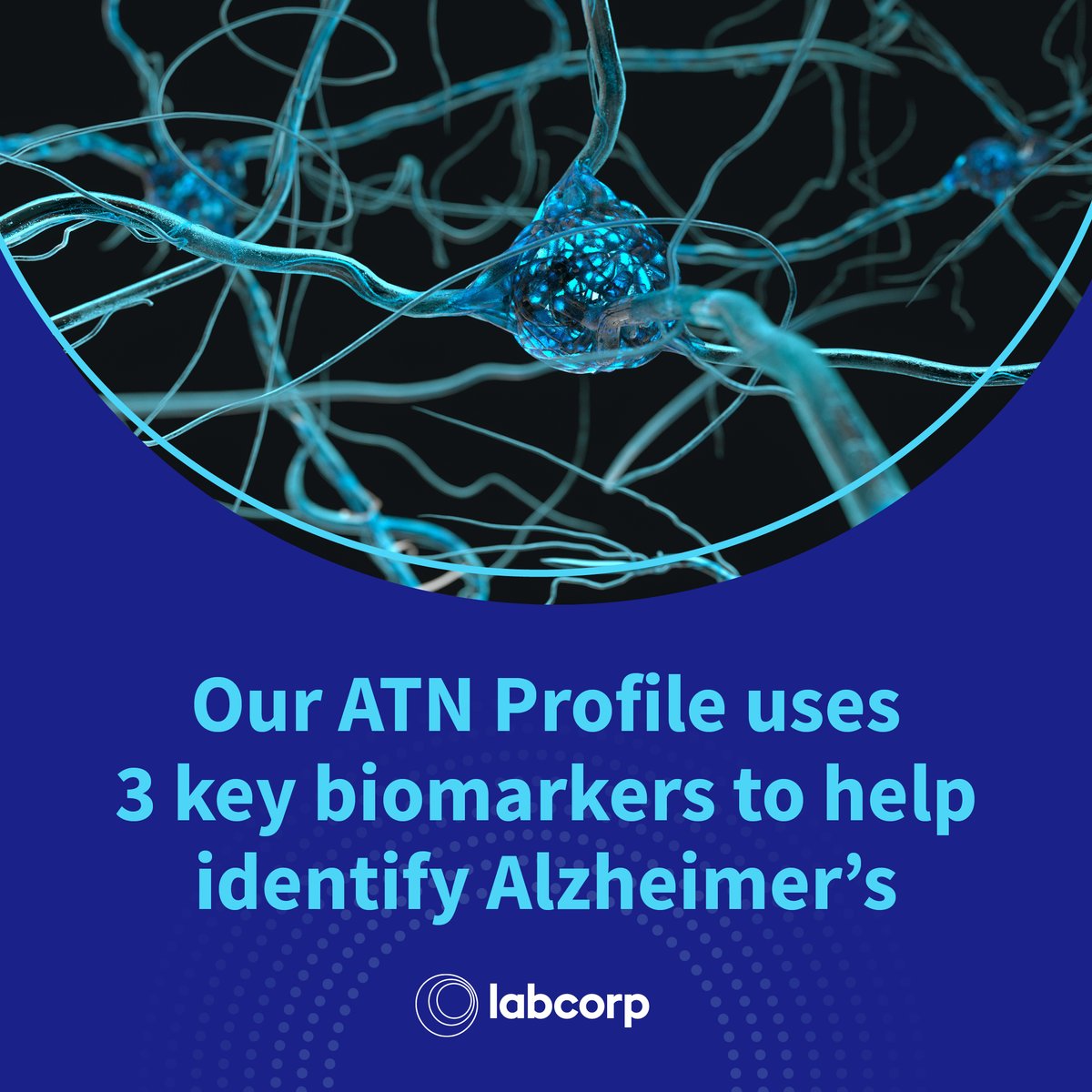 Too often, #AlzheimersDisease diagnoses are delayed, but Labcorp is helping to change that. With our new blood-based ATN Profile, we are accelerating the path to diagnosis and enabling earlier treatment. Read the full press release: spr.ly/6017urowc