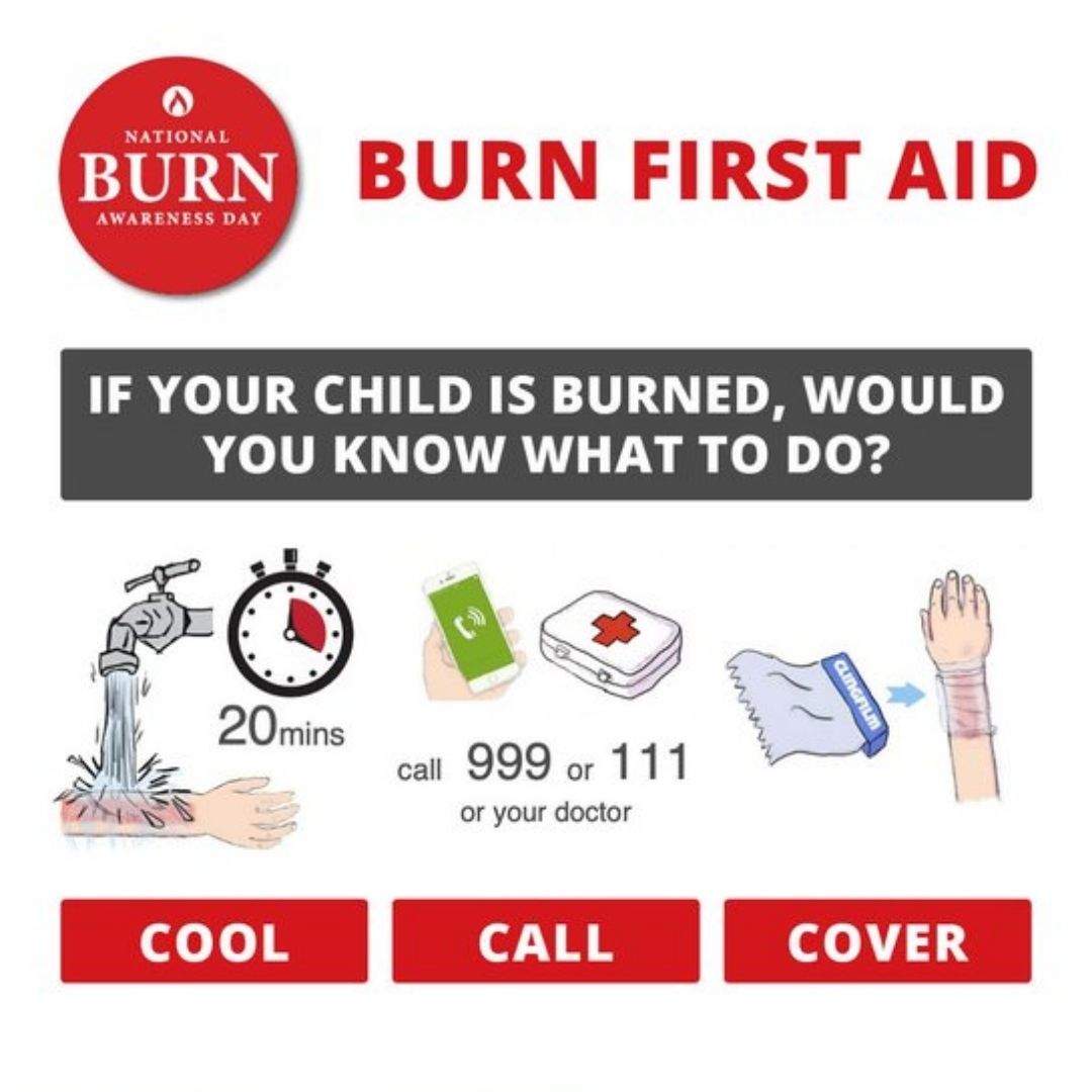 First aid following a burn injury can make a significant difference in severity and recovery. 

🔥COOL, CALL, COVER🔥

@CBTofficial 

#STOPTEABER #BeBurnsAware #FamilyOops #CoolCallCover #NBAD2023 #coolwater20mins