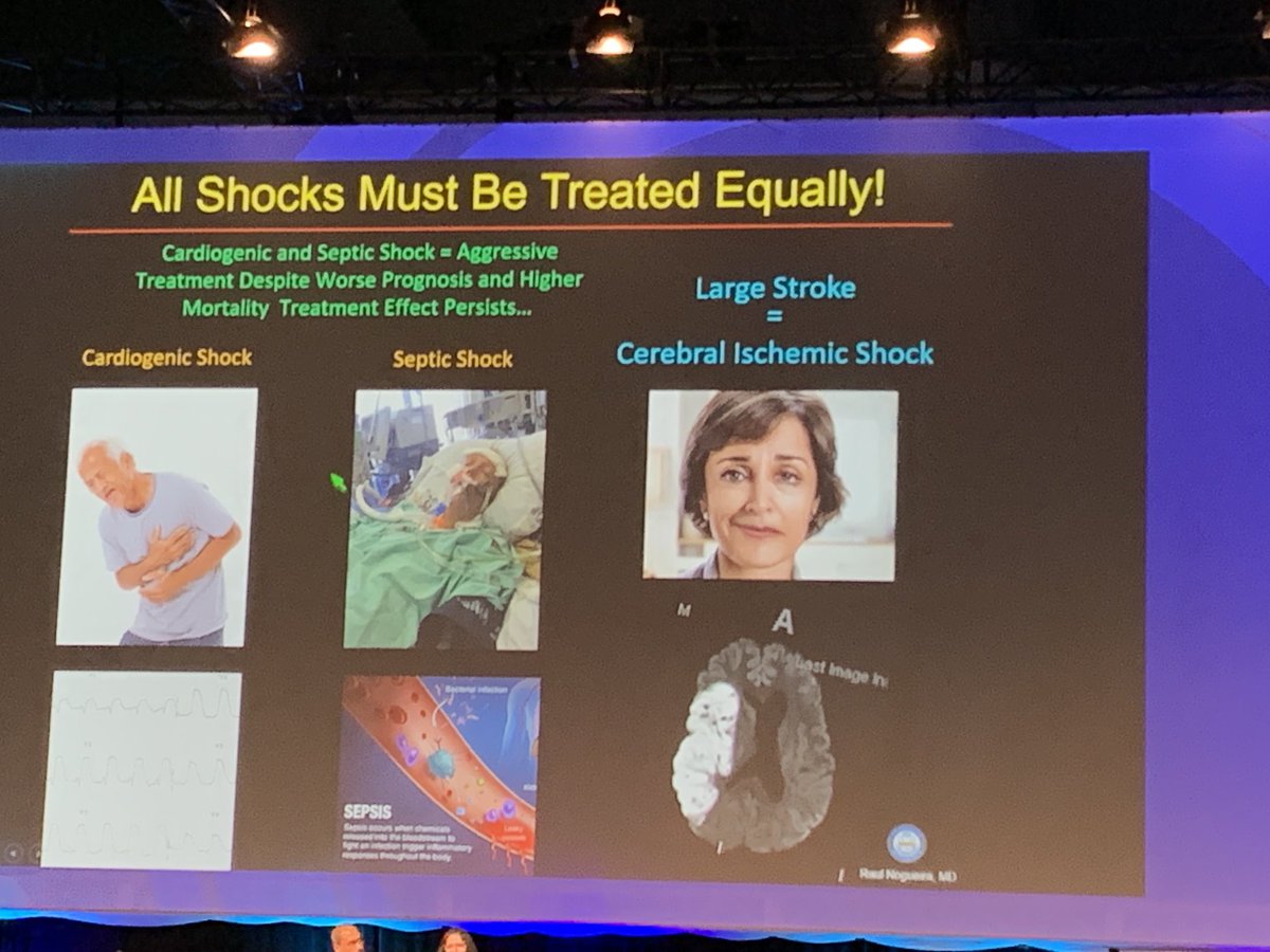 Seemant Chaturvedi (@chaturvedineuro) on Twitter photo Brilliant Presidential award talk by Dr Raul Nogueria at #WSC23. Overview of the progress leading to EVT and the path forward to benefit patients across the globe. Congrats <a href="/RaulNogueiraMD/">Raul G Nogueira, MD, FAHA, FSVIN</a> <a href="/svinsociety/">SVIN</a> <a href="/WorldStrokeOrg/">World Stroke Org</a> <a href="/ESOstroke/">European Stroke Org</a> Brilliant Presidential award talk by Dr Raul Nogueria at #WSC23. Overview of the progress leading to EVT and the path forward to benefit patients across the globe. Congrats <a href="/RaulNogueiraMD/">Raul G Nogueira, MD, FAHA, FSVIN</a> <a href="/svinsociety/">SVIN</a> <a href="/WorldStrokeOrg/">World Stroke Org</a> <a href="/ESOstroke/">European Stroke Org</a> 
