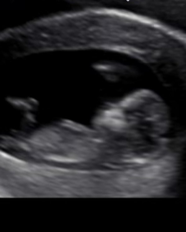 Exciting news for our 6 year anniversary!  Aleisha and I can’t wait to welcome a new addition to our lives April 2024!
Never expected 6 years ago that I would being going out on a date with the love of my life, my wife, and now the mother of my child.