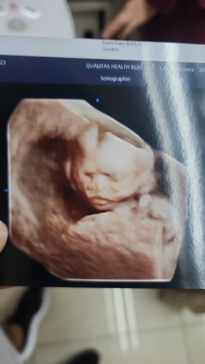 syhryusof's tweet photo. Dear, Helena. 

One day, when you're big enough to witness this tweet, since me n mummy discover we're having a baby, you brought a lot of joy and challenges into our life.

None of the challenges ignite a quarrel between me and mummy. 

You're the best birthday present ever 💓 https://t.co/Gb3g6dKDiX