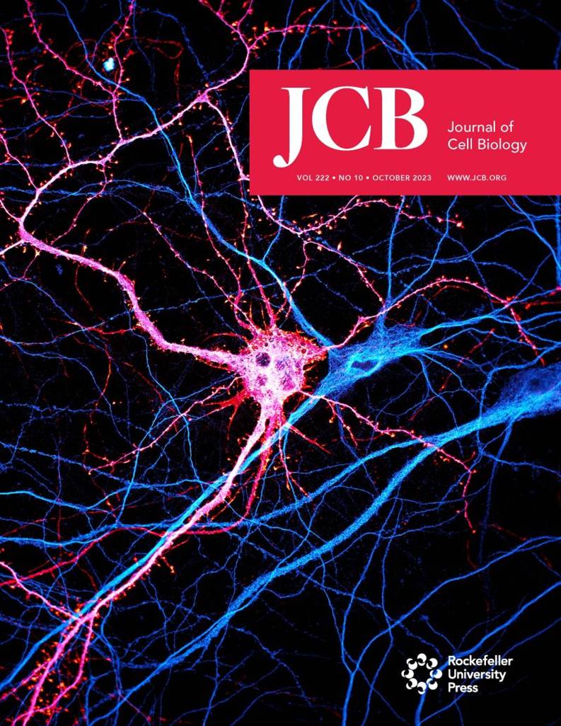 NikonInst's tweet photo. Congrats to @christlet and the Neuro Cyto Lab for having their image of the neuronal cytoskeleton featured on the cover of the Journal of Cell Biology! It was captured using a CSU-W1 SoRa system at our Center of Excellence in Marseille. Click for article: https://t.co/qGCAG3DGWc https://t.co/RXzZiCQZzF