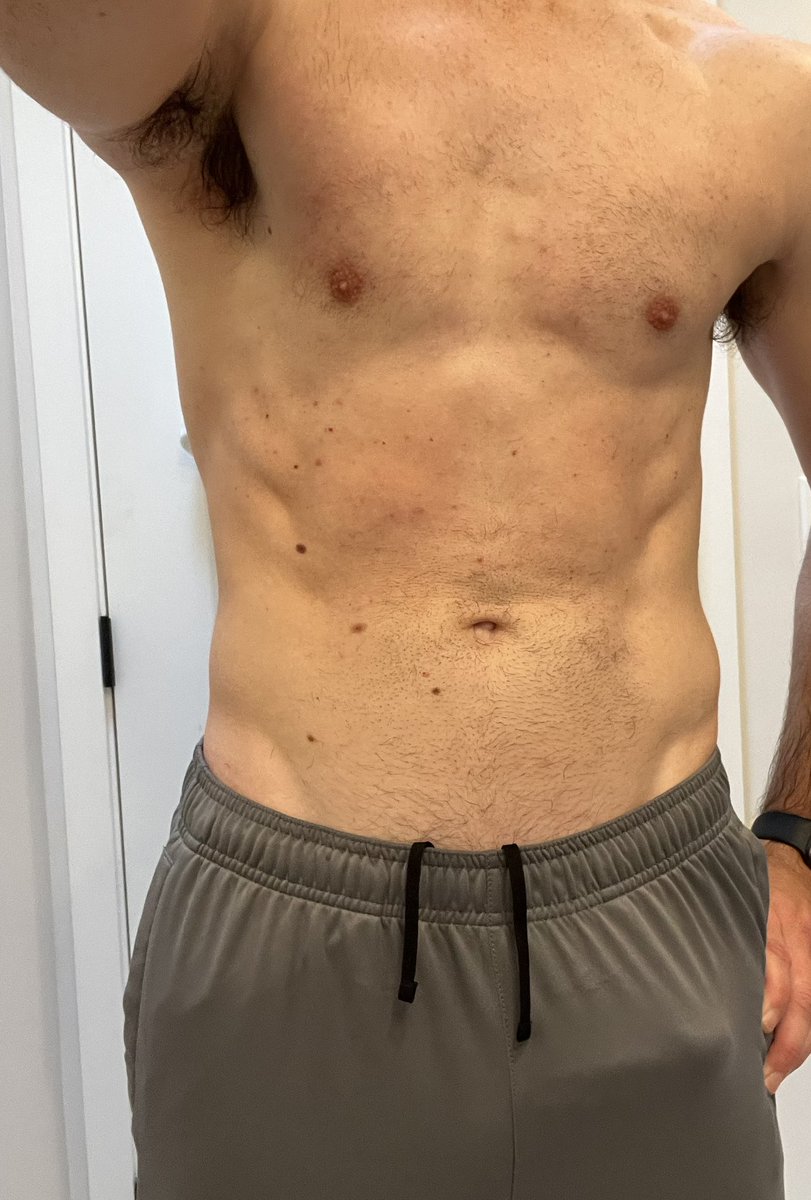 Dirk Richter tweet media
