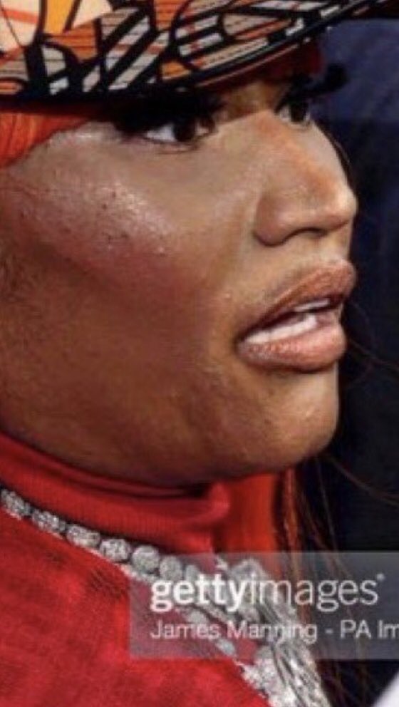 Marioo_Pena's tweet photo. @onikalux @BeyyCardi @babesmithh @girlsinrap She LITERALLY does not! Cardi looks young, Nicki looks like this... https://t.co/1K1nEbXprg