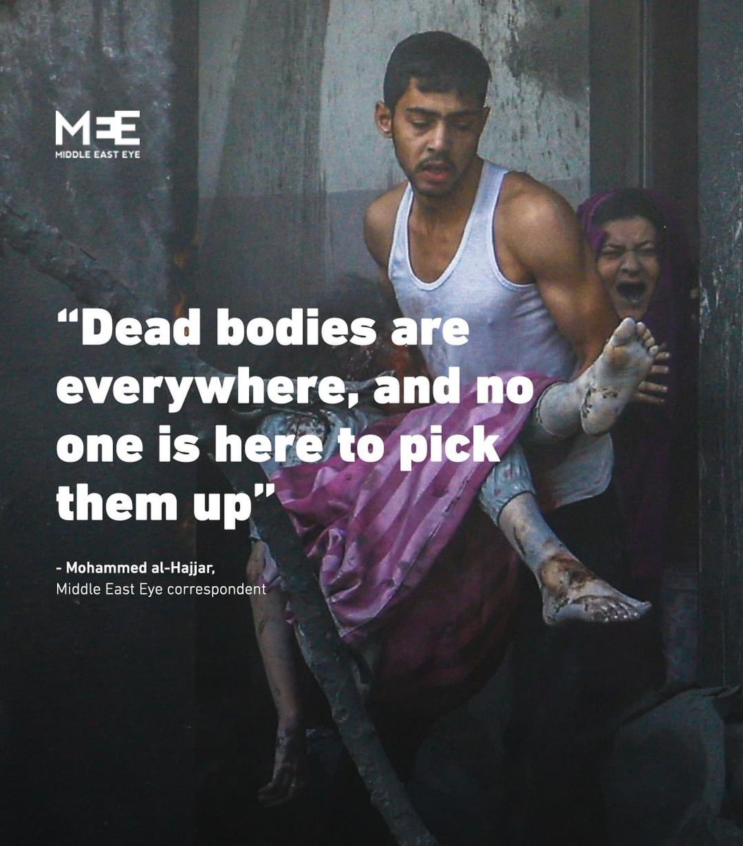KhaledAlsayed00's tweet photo. Don’t let the CNN and BBC fool you, 
They brainwashing people to believe what they want you to believe.
#GazaUnderaAttack 
#FreePalestine 
#TheRealImage 
#GazaUnderAttack https://t.co/zMJlQIgJgZ