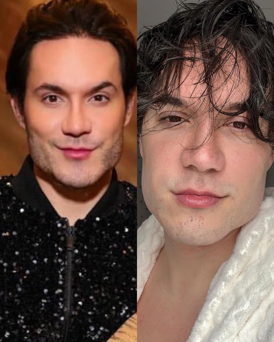 nanarude's tweet image. Após sua foto com Viih Tube viralizar durante o Prêmio Glamour, na segunda-feira (9), Eliezer falou sobre ter feito ou não uma nova harmonização facial. Segundo o ex #BBB22, a ausência da barba, somado ao penteado, teria deixado seu rosto diferente.