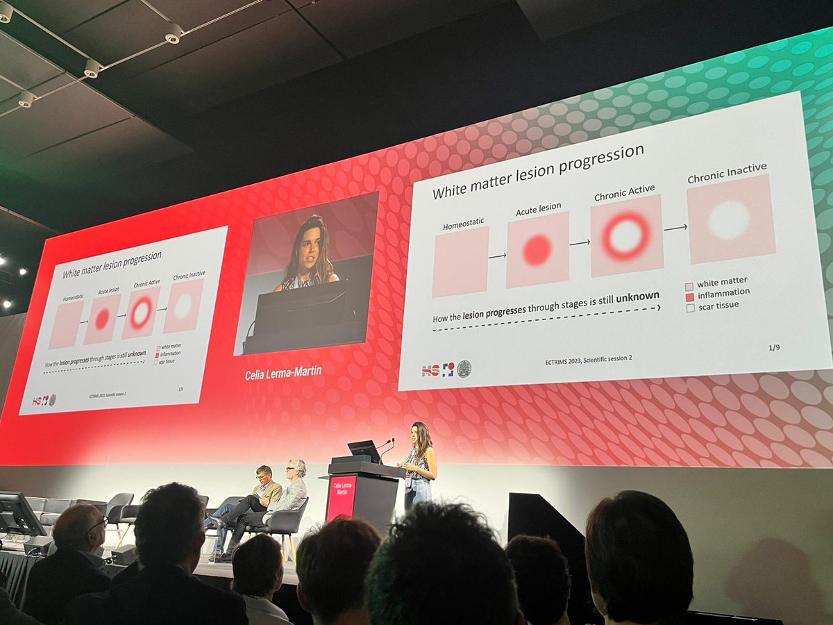 🧠 Delighted to have shared today our research on MS lesions from white matter at #ECTRIMS2023 in Milan! I've talked about how our single-nuc and spatial atlas sheds light on disease progression. Grateful for the opportunity to present and happy to see that the room was packed 😊