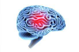 Traumatic brain injury and dementia - the work goes on!
theohucklekc.com/post/traumatic…