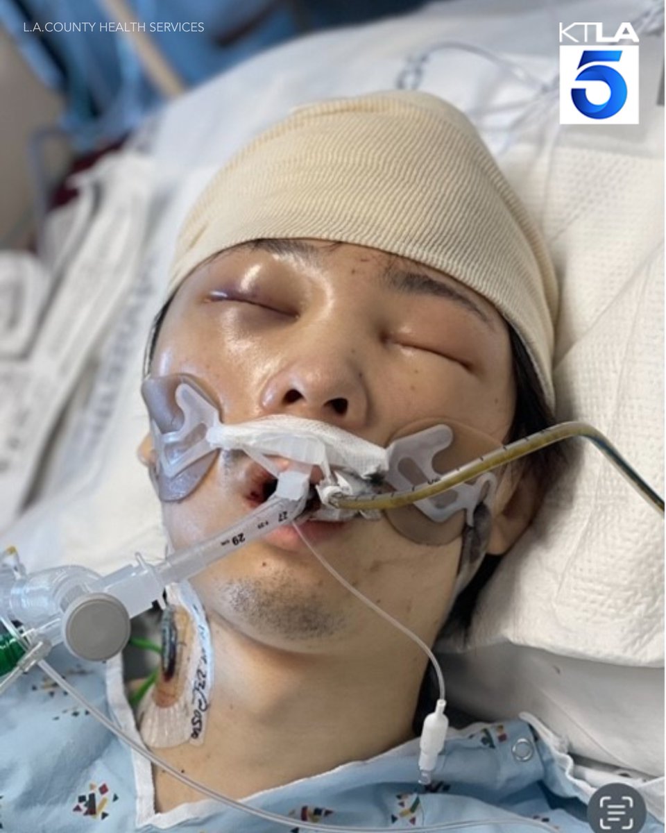 KTLA's tweet image. DO YOU KNOW HIM? Unidentified man found with traumatic brain injury, Japanese currency in San Pedro ktla.com/news/local-new…