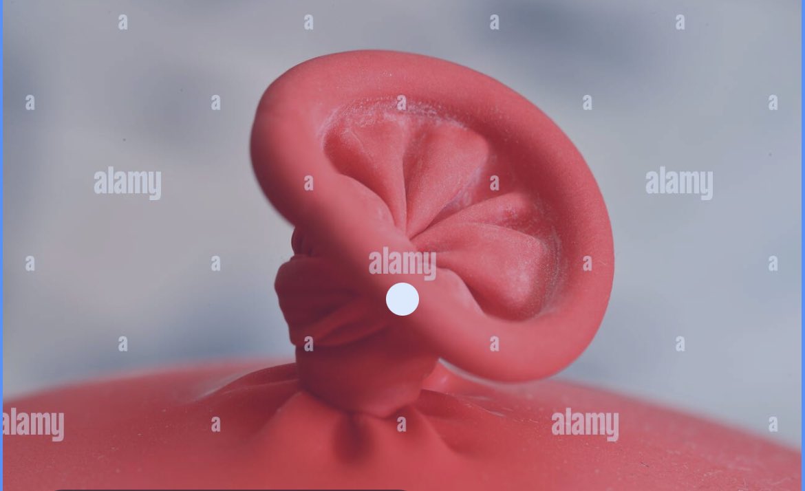 clamSLAM3000 tweet media