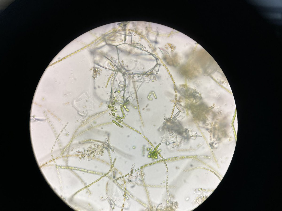 cbellissimo_'s tweet photo. Hello, 
Can anyone tell me what this alga is?

#Phycology
#Microalgae
#Phytoplankton https://t.co/dooHKOtYyt