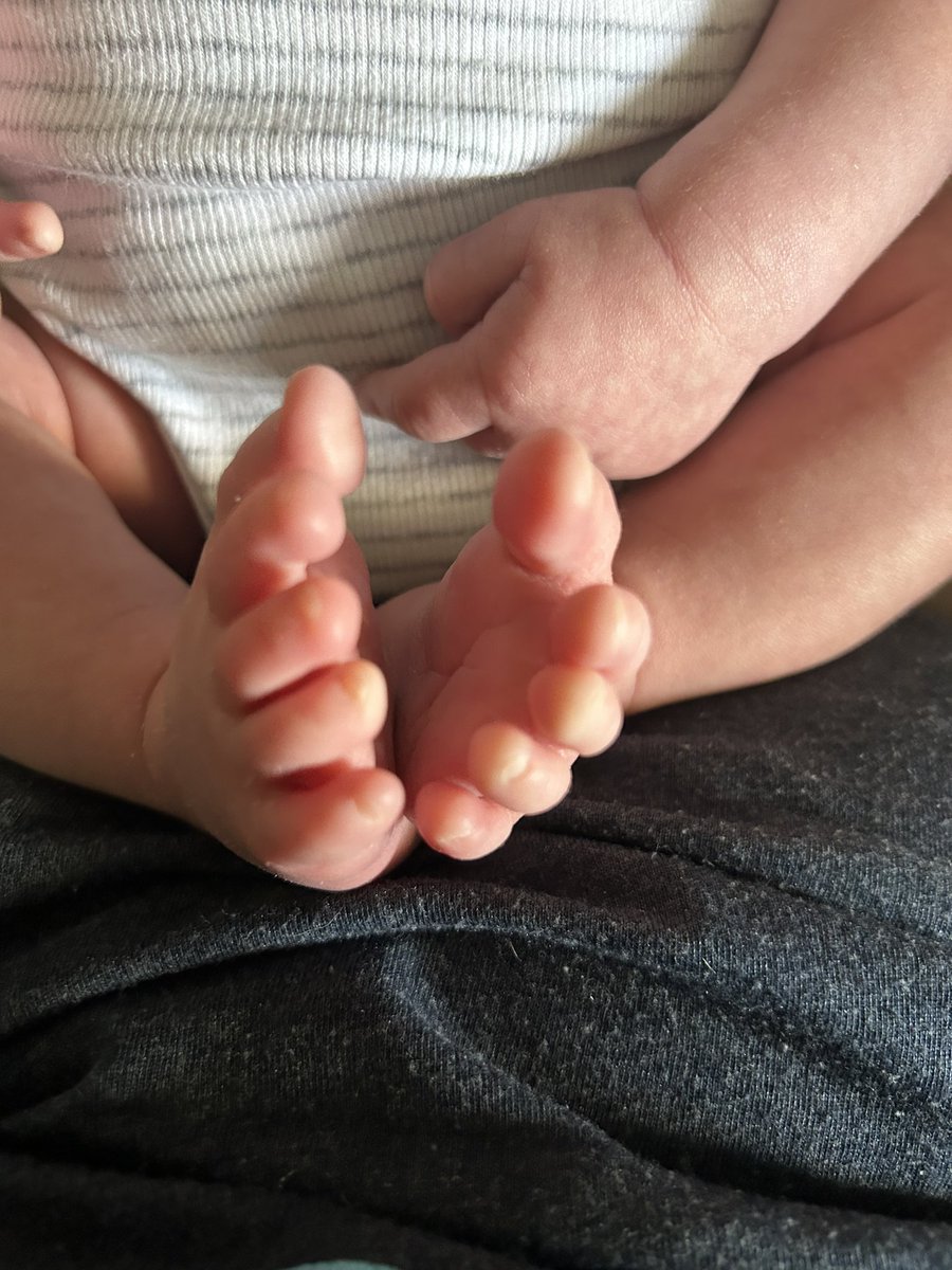 Baby toes 😍