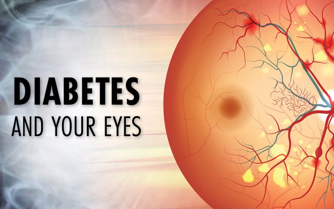 Today's #WorldSightDay 🌍👁️
--
Let's shed light on the link between #Diabetes and your #Eyesight

Regular Eye check-ups and effective Diabetes management are essential for preserving your vision

Diabetes care services are readily accessible at all HealthCenters @RwandaHealth 🩺