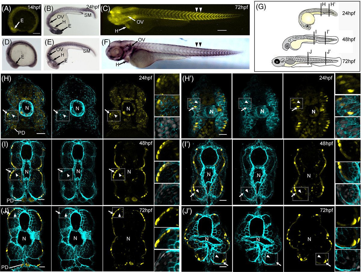 DevelopmentalDy's tweet photo. #Betaglycan is the TGFβ type III receptor that modulates #TGFβ family signaling. Learn how Betaglycan (tgfbr3) is regulated during #somite #muscle development in #zebrafish and preferentially marks adaxial cells and their descendants. https://t.co/nc7gi1O2W7 https://t.co/ChxoohVDbp