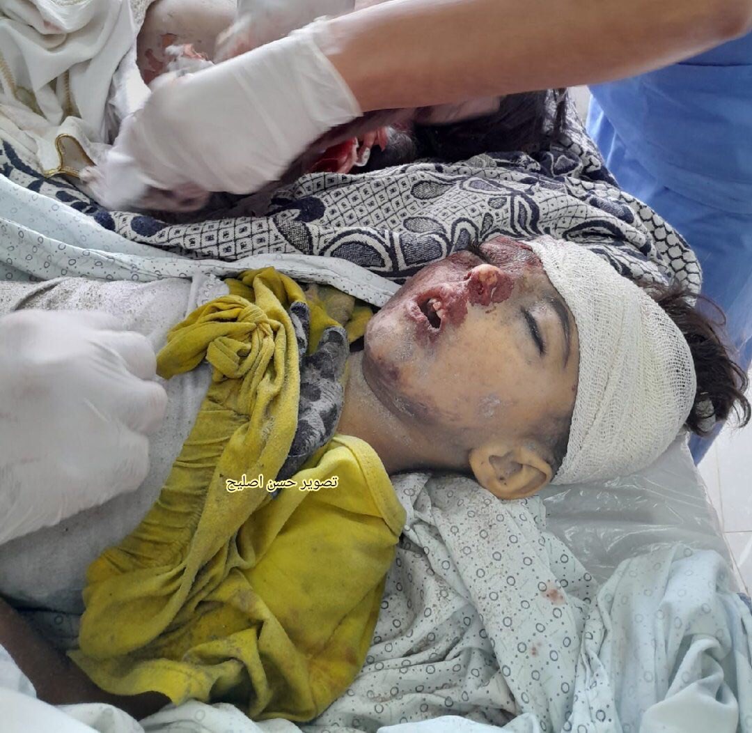 RebaiGhina's tweet photo. #Israel killed Palestinian babies using American weapons.
The US regime sponsors Israeli terrorist crimes and maintains the Israeli terrorist occupation on #Palestine.
The US regime is the main enemy of the #Palestinian_Cause, and Israel is but its cancerous limb in west Asia.
#Gaza #GazaUnderAttack #PrayForGaza #FreePalestine