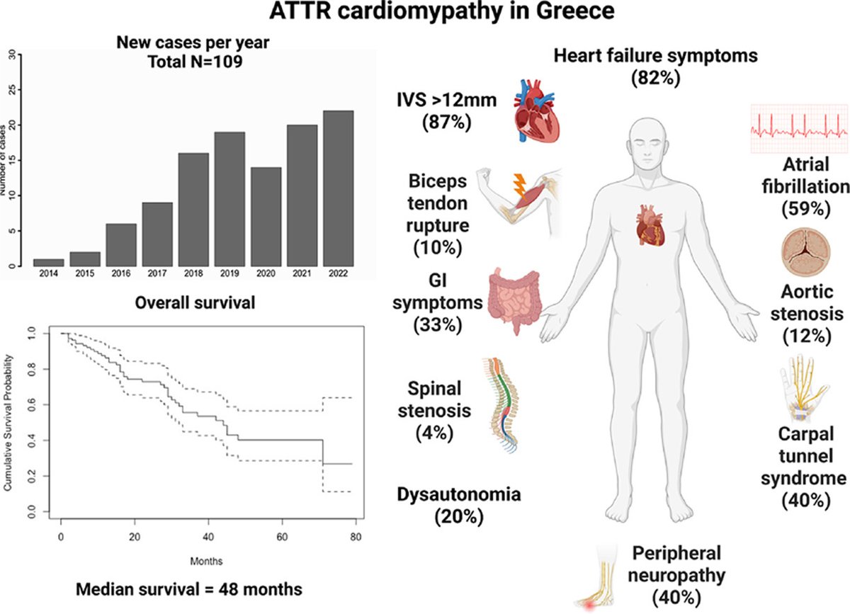 Transthyretin Amyloidosis Cardiomyopathy in Greece: Clinical Insights from the National Referral Center

doi.org/10.1016/j.hjc.…