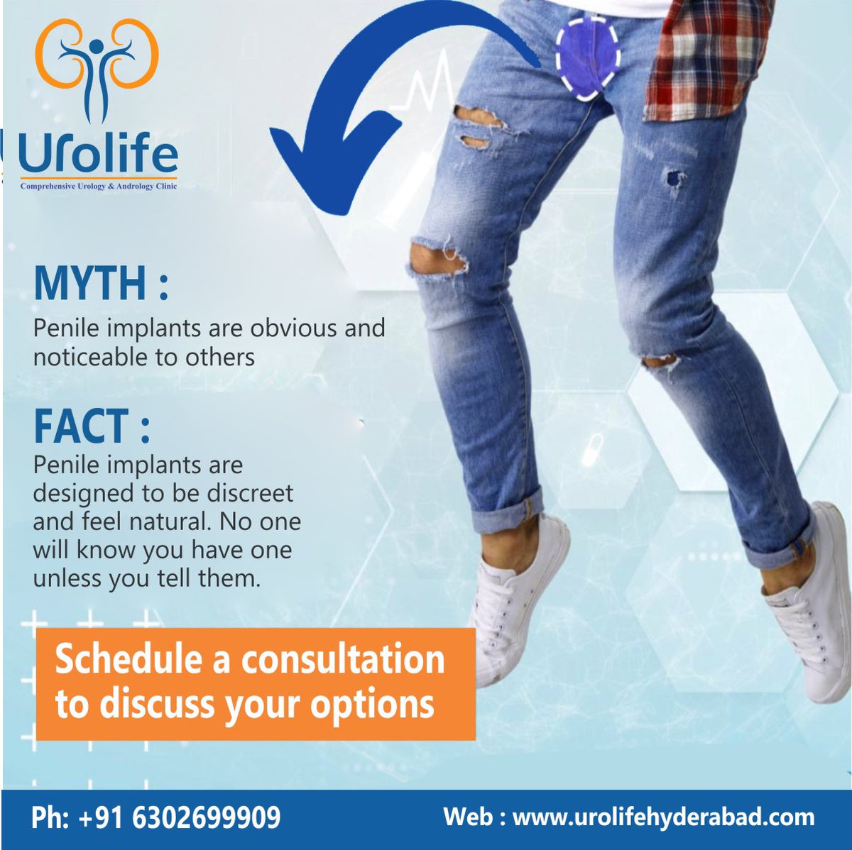 Schedule a consultation to discuss your options

Best penile treatment in Hyderabad 

#penileimplant #penileimplants #penileimplantcost #penileimplantsurgery #maleinfertility #male #infertility #infertilityjourney #infertilitysupport #andrology #andrologyteam #andrologyclinic