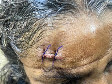 কালিয়াকৈরে মা ছেলেকে কুপিয়ে জখম