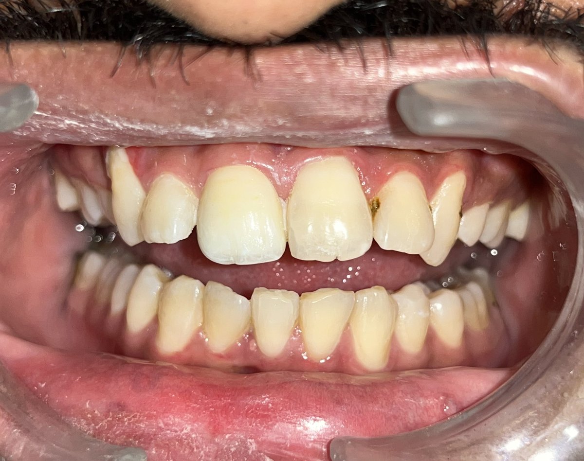 dipakraval69's tweet photo. Your smile is important to us https://t.co/u1RBHEedYt