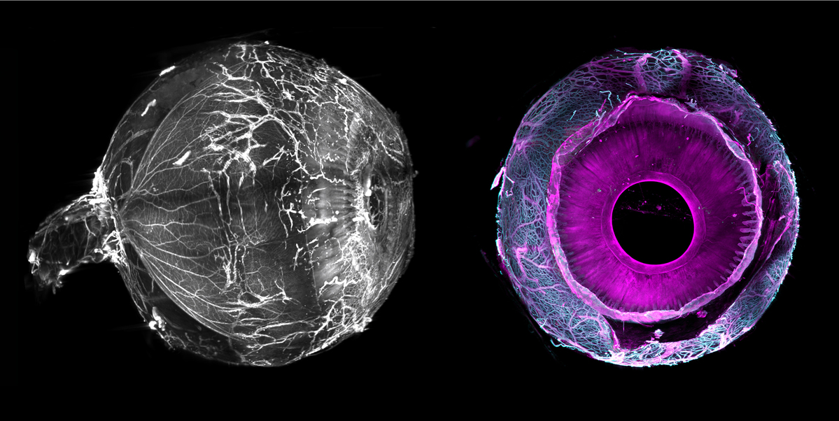 QUINZE-VINGTS tweet media