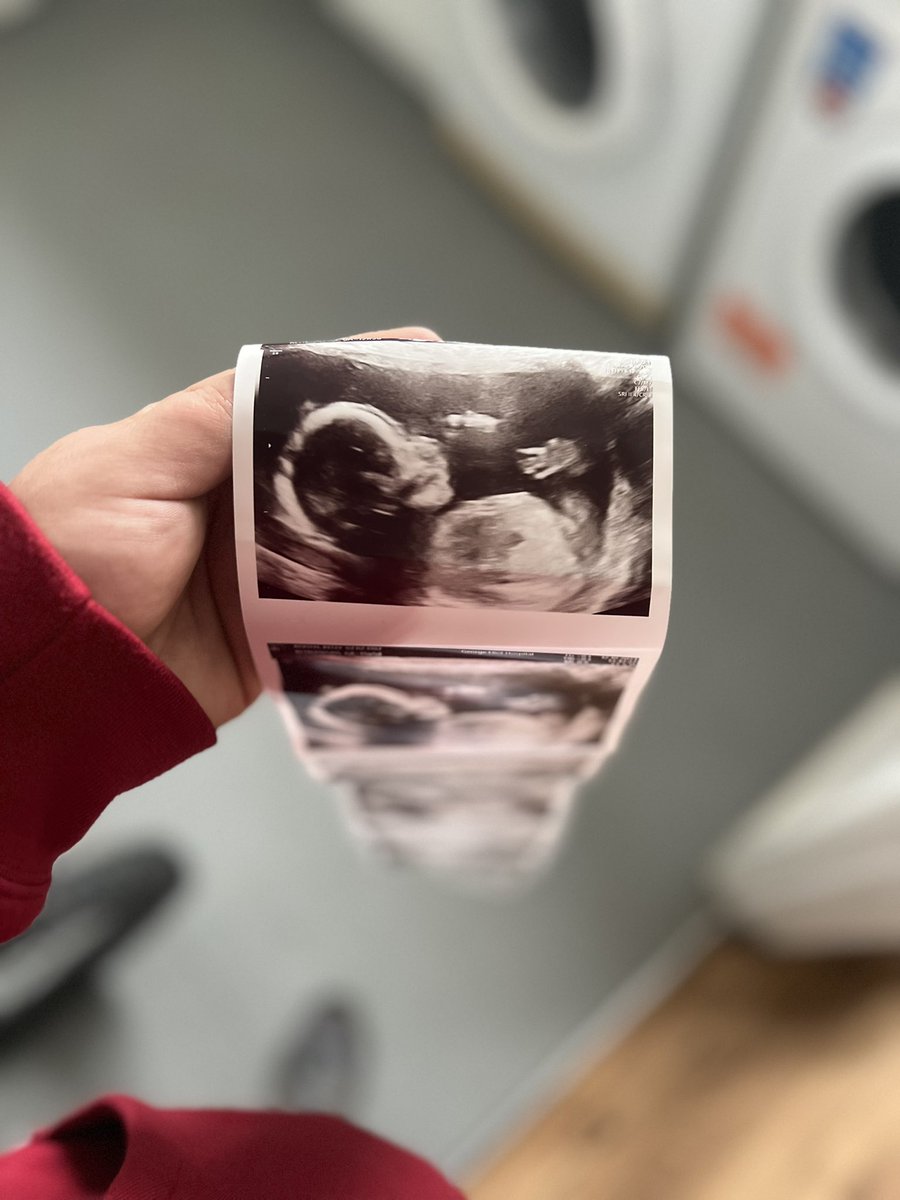 Lootboxxuk's tweet photo. Baby hammer in the oven is a boy 💙💙💙💙💙💙💙💙💙 ⚒️⚒️⚒️⚒️⚒️⚒️⚒️⚒️ https://t.co/ftl2YQO0ZV