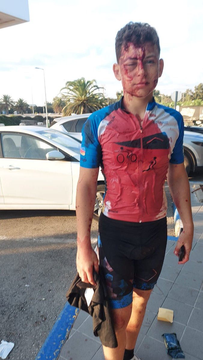 NSNCyclingTeam's tweet photo. The last ride: Israel's cycling community faces unthinkable losses

The riders who were gunned down.

The cyclists who hid under a bush for hours, playing dead.

A 15-year-old cyclist who was ambushed, shot at, and became a hero.

These are just some of the stories of the Israeli cycling community. Read more: https://t.co/5AkOdgukdI 

#WeStandByIsrael