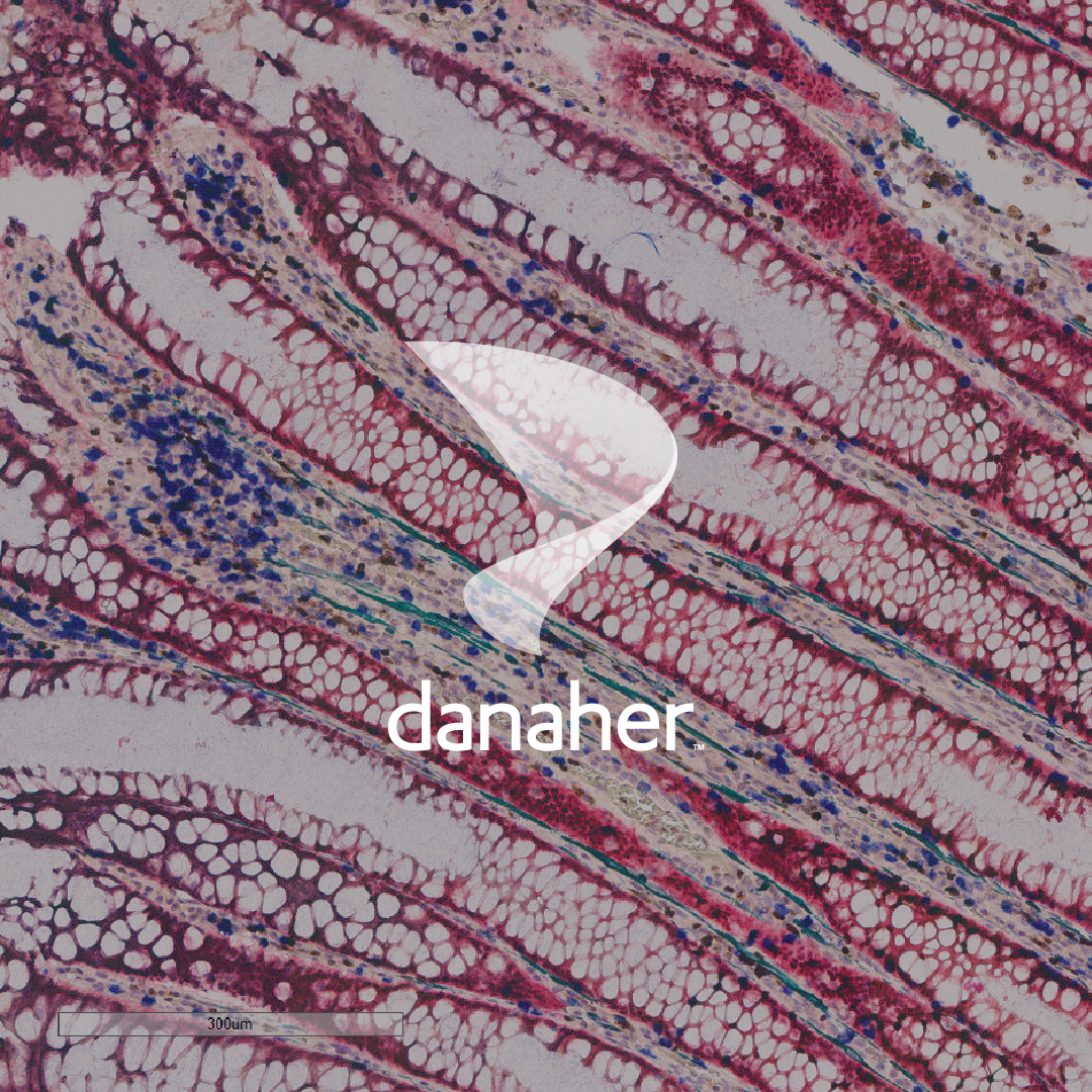 LeicaBio's tweet photo. Leica Biosystems is proud to be part of Danaher.

Danaher is a global science and technology leader. Together, we combine our capabilities to accelerate the real-life impact of tomorrow’s science and technology to improve human health. https://t.co/JXlJUgnqq2