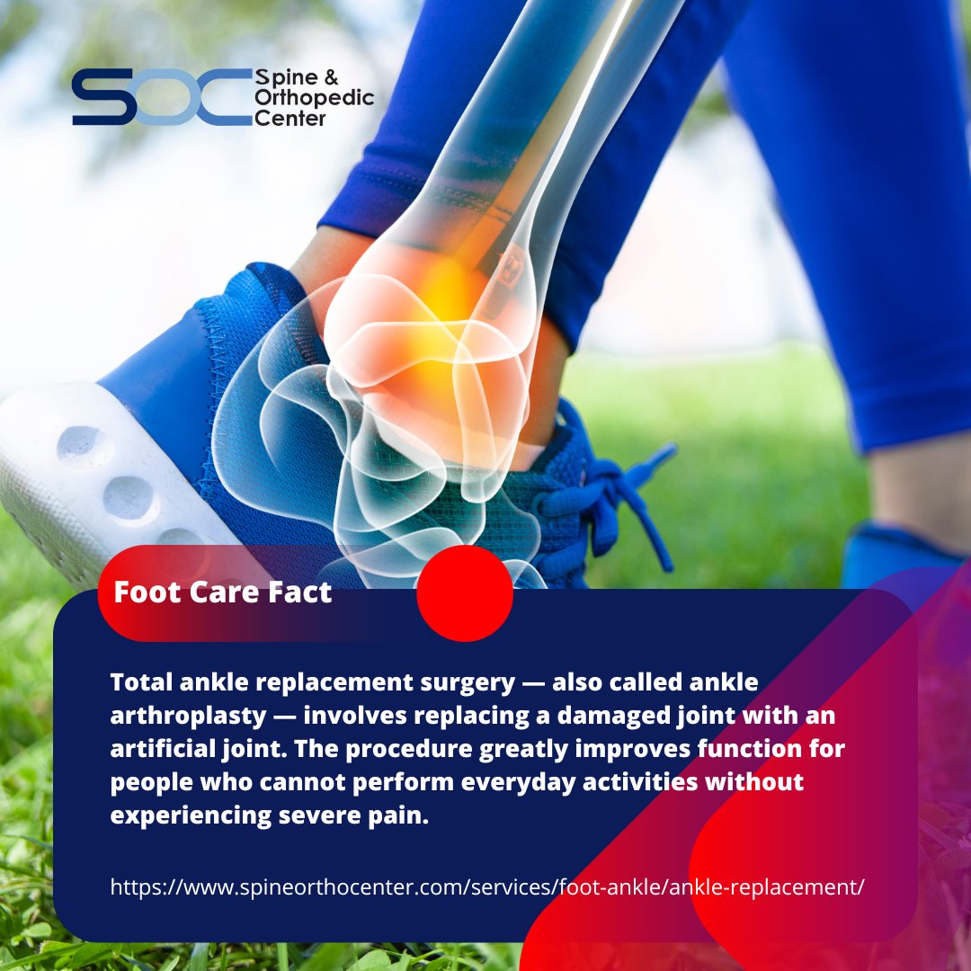 SOC_Spine's tweet photo. Proper foot care is essential for a healthy, active life! 👣 But sometimes, foot issues can't be solved with conservative measures. Are you curious about ankle replacement surgery and how it can transform lives?
https://t.co/50LD0huVng
#HealthFacts #AnkleReplacement #DrMacGill https://t.co/nya4eFp86p