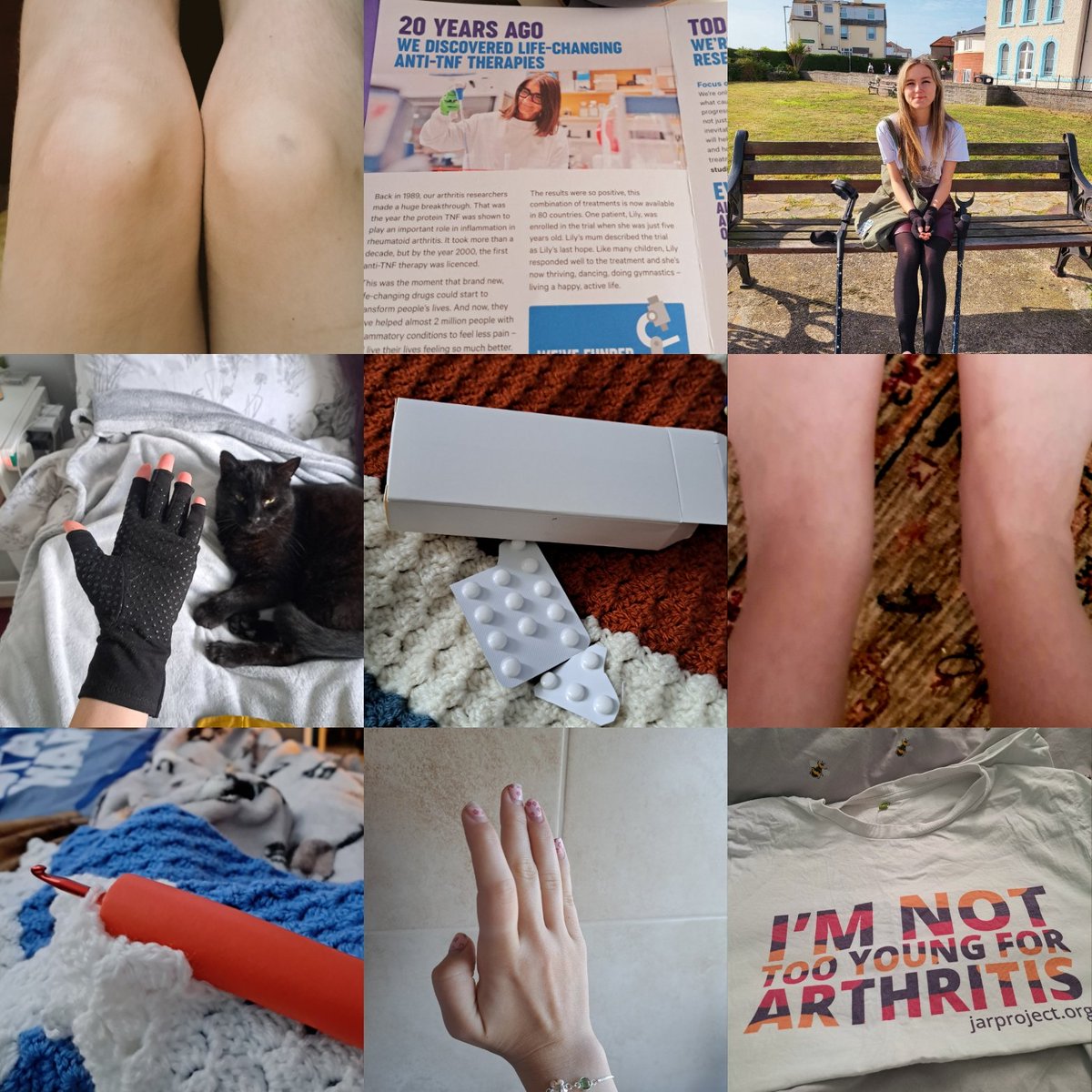 This #WorldArthritisDay I'm reflecting on my journey with #JIA and the debilitating impact it's had on my life. Arthritis is more than just painful joints. It impacts every aspect of a person's life. It's also shaped me into the resilient & determined person I am today