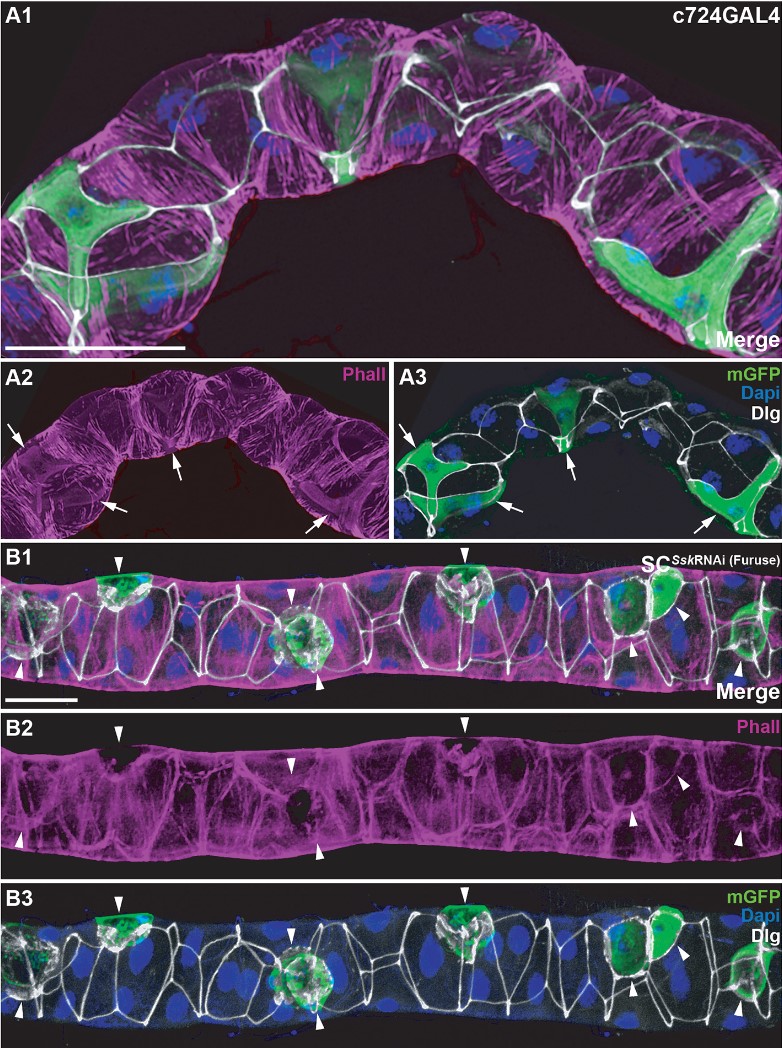 J Cell Science (@j_cell_sci) on Twitter photo <a href="/anthony_dornan/">Dornan has left the building....💙🇺🇦</a> <a href="/HalbergLab/">HalbergLab</a> <a href="/tubuleguy/">Julian Dow</a> and colleagues find that age-dependent decline in renal function is associated with compromised barrier integrity, which is phenocopied by acute loss of Snakeskin.
Highlight: journals.biologists.com/jcs/article/13…
Article: journals.biologists.com/jcs/article/13… <a href="/anthony_dornan/">Dornan has left the building....💙🇺🇦</a> <a href="/HalbergLab/">HalbergLab</a> <a href="/tubuleguy/">Julian Dow</a> and colleagues find that age-dependent decline in renal function is associated with compromised barrier integrity, which is phenocopied by acute loss of Snakeskin.
Highlight: journals.biologists.com/jcs/article/13…
Article: journals.biologists.com/jcs/article/13…