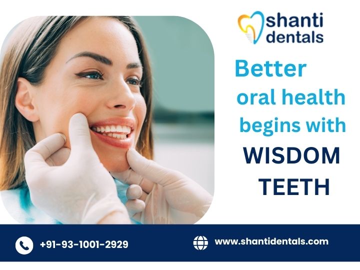 Get Best #WisdomTeethTreatment in Rohini Delhi Visit Us: shantidentals.com

#Wisdomteeth #Oralhealth #WisdomTeethRemoval
#DentalSurgery
#OralSurgery
#RecoveryJourney
#PainManagement
#DentalCare
#PostOpCare
#OralHealth
#ToothExtraction
#OralHealthMatters
#WisdomTeeth