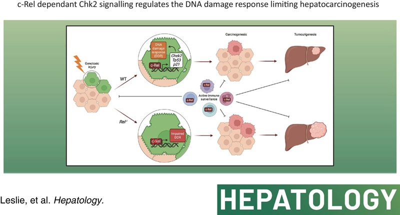 Leslie J et al. c‐Rel–dependent Chk2 signaling regulates the DNA damage response limiting hepatocarcinogenesis
#LiverTwitter 
shorturl.at/lLTX9