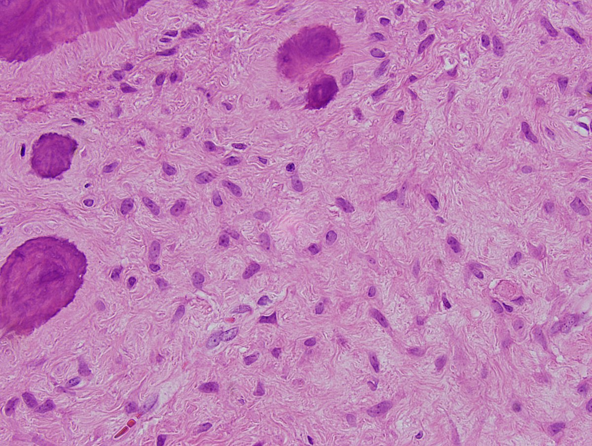 cygupath_md tweet picture