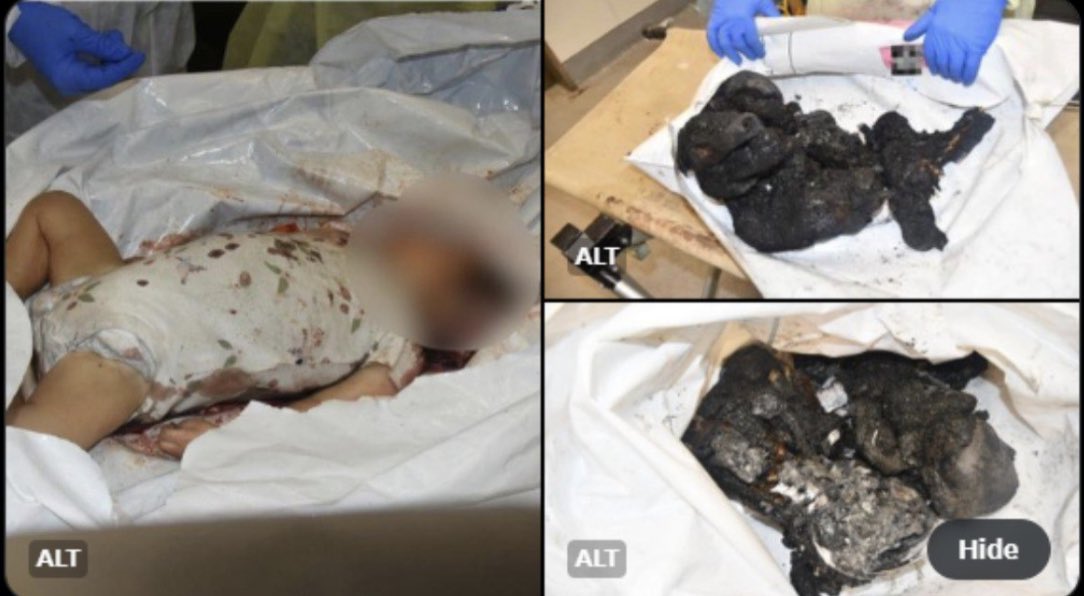 karinamichelin's tweet photo. O primeiro-ministro Benjamin Netanyahu mostrou ao secretário de Estado dos EUA, Antony Blinken - que logo após foi publicada em sua conta no X - uma foto de um bebê queimado brutalmente. 

O assassinato dos 40 bebês gerou controvérsia pelo fato de não terem provas que comprovassem tal barbárie, mas há poucas horas Netanyahu resolveu expor o crime. 

Em sua conta X ele escreve: 

“Aviso: Estas são fotos horríveis de bebês assassinados e queimados pelos monstros do Hamas.
O Hamas é desumano.
Hamas é ISIS.” 

@IsraeliPM